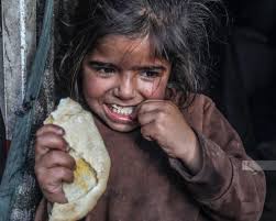 الأونروا : أكثر من 50 ألف طفل في غزة يحتاجون للعلاج من سوء التغذية الحاد