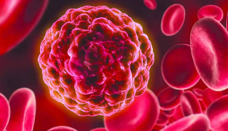 المستشفى التخصصي ينظم محاضرة توعوية حول سرطان البروستات 