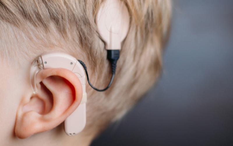 هام لمن يحتاجون زراعة قوقعة .. لجنة أطباء تجريها مجاناً (تفاصيل)